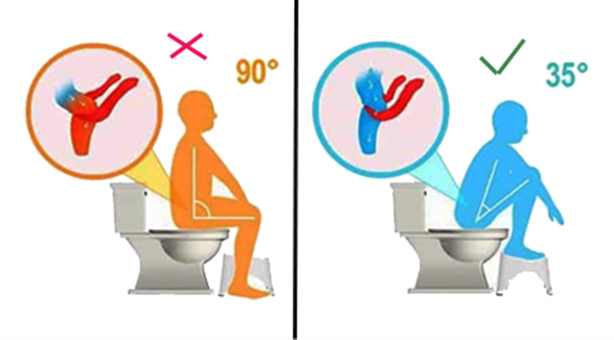 مشکلات نشستن به صورت 90 درجه بر روی توالت فرنگی